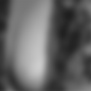 rencontre-Trans-Calais